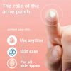 GlowAffair Invisible Pimple Patches | 200, 400 or 800 Hydrocolloid Spots